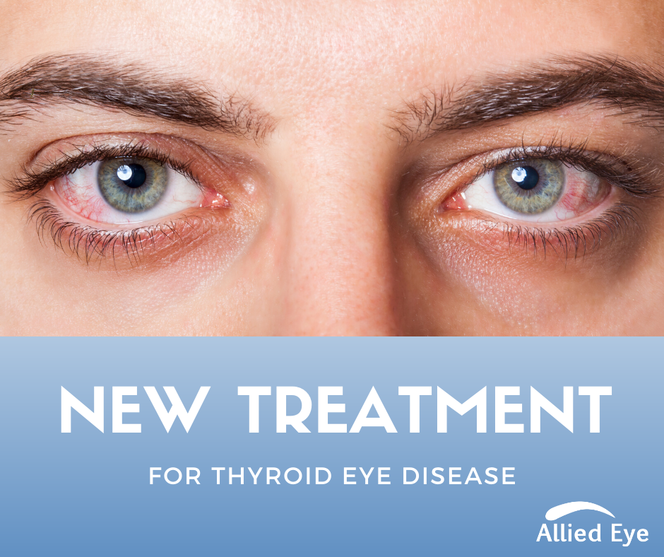 New Treatment for Thyroid Eye Disease
